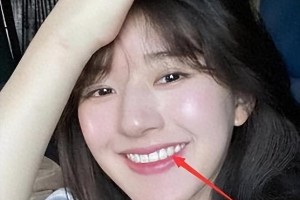 赵露思健康危机：从“搞笑女”到被“白幼瘦”审美压垮